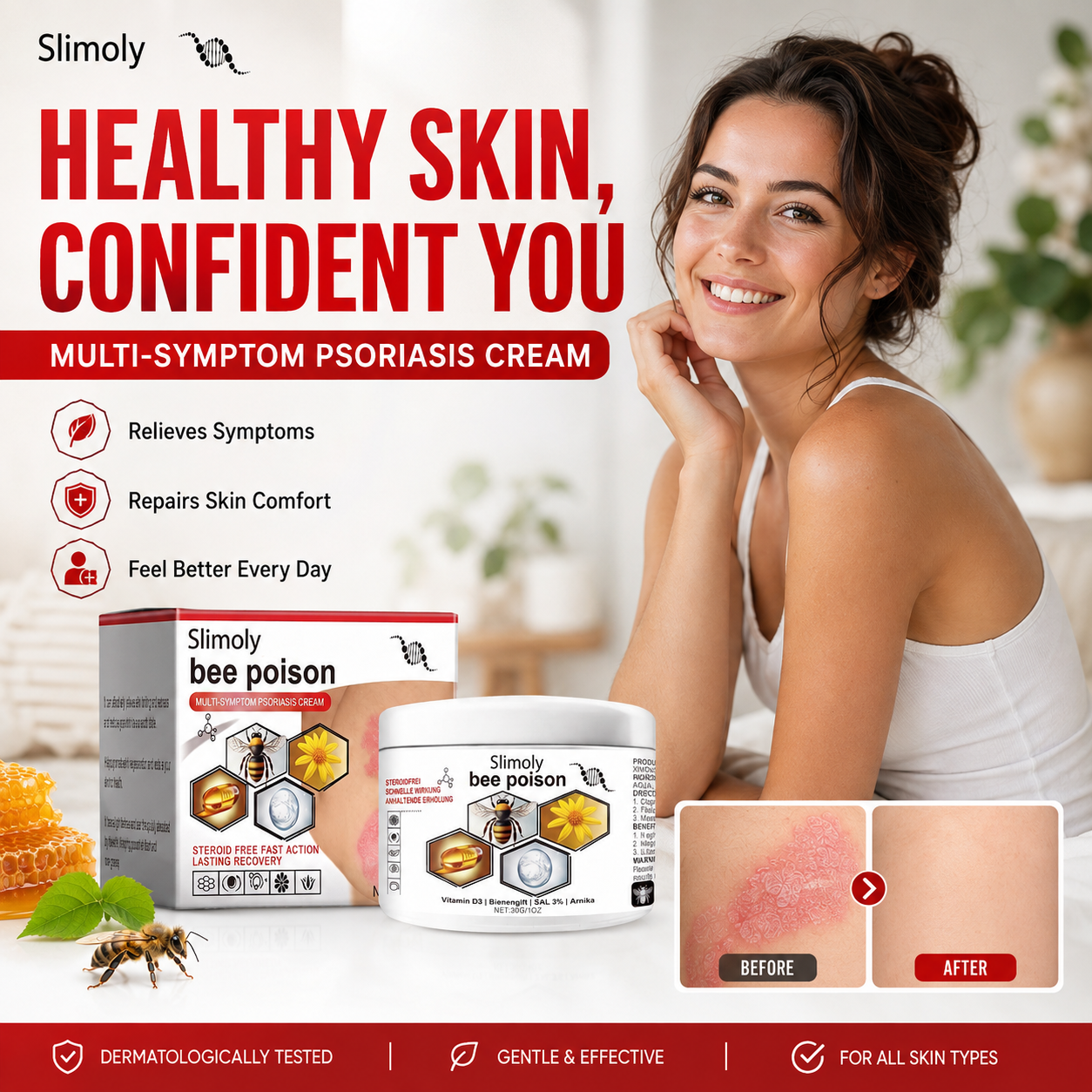 Slimoly™ Bee Poison Psoriasis Rescue Cream – Soothe Dry, Flaky & Itchy Skin