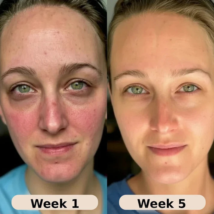 LOVILDS® Collagen Firming Serum – Hydrate, Plump & Restore Youthful-Looking Glow