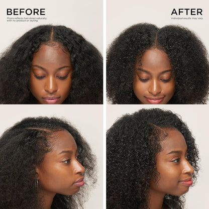 Scalp Revitalizing Solution Hair Thickening Roll On Serum